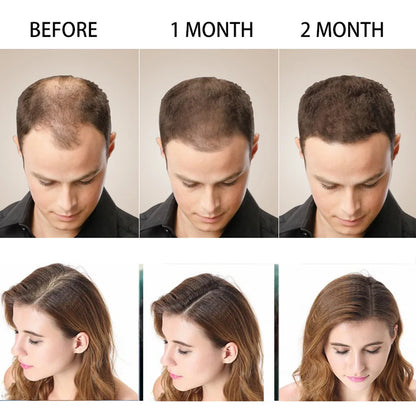 Disaar Hair Shampo Anti-Hair Loss