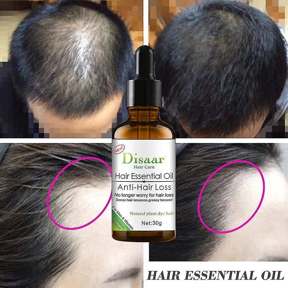 Disaar Anti Hair Loss Hair oil