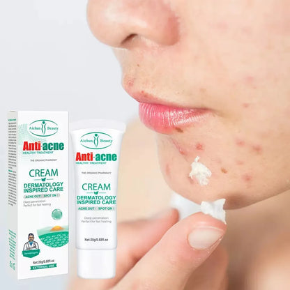 Aichun Beauty Anti-Acne Cream