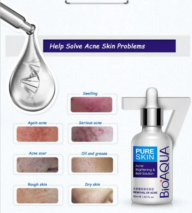 Bio Aqua Pure SKIN Acne Removal & Brightening serum