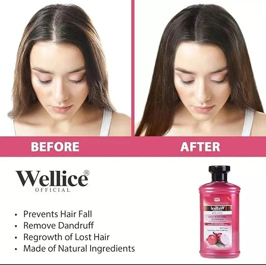 Wellice Onion Anti Hair Loss Oil For Hair Regrowth